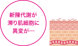 新陳代謝が滞り肌細胞に異変が…