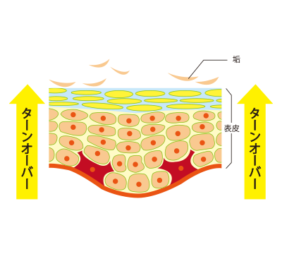 ターンオーバー