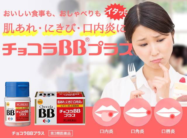 おいしい食事も、おしゃべりもイタッ！肌あれ・にきび・口内炎に チョコラBBプラス 口内炎 口角炎 口唇炎