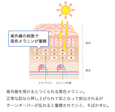 紫外線を受けるとつくられる黒色メラニン。正常な肌なら押し上げられて垢となって排出されるがターンオーバーが乱れると蓄積されてシミ、そばかすに。